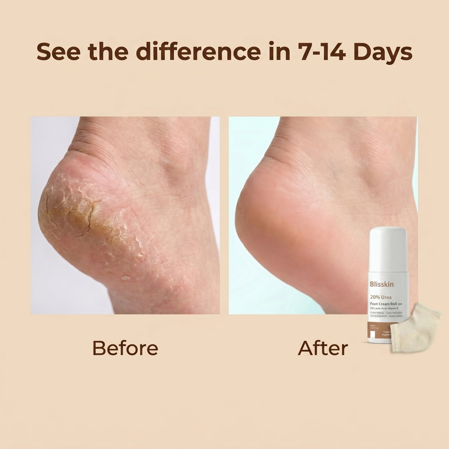 Blisskin Foot Revival Kit